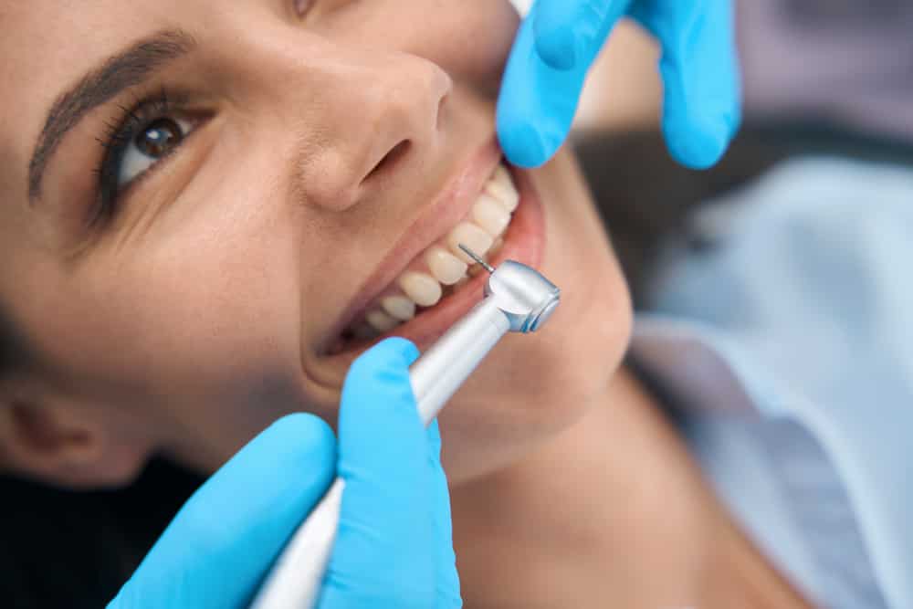 Preventive Dentistry: How Often to Prioritise Dental Cleanings